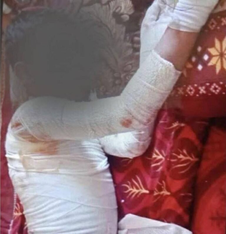 شعله‌های اعتراض؛ کودک ۱۰ ساله‌ای که در پکتیکا خود را آتش زد