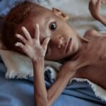 هشدار برنامه جهانی غذا: میلیون‌ها زن و کودک افغان در آستانه سوء‌تغذیه مرگبار